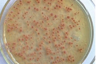 生物處理效果差(低溫對(duì)微生物菌種危害性很大)